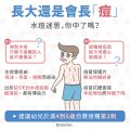 水痘1.jpg