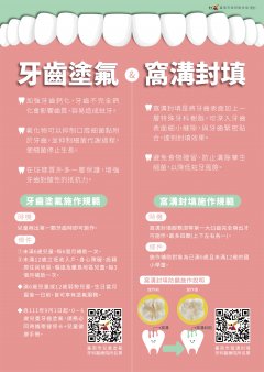 牙齒塗氟及窩溝封填jpeg.jpeg